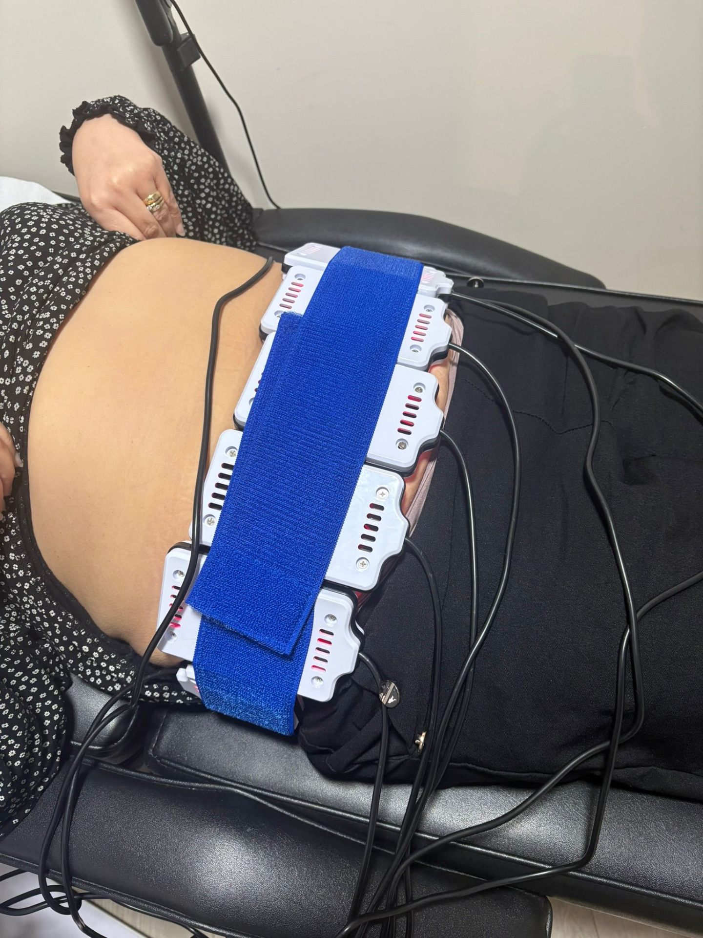 Laser lipo and body contouring treatment in session